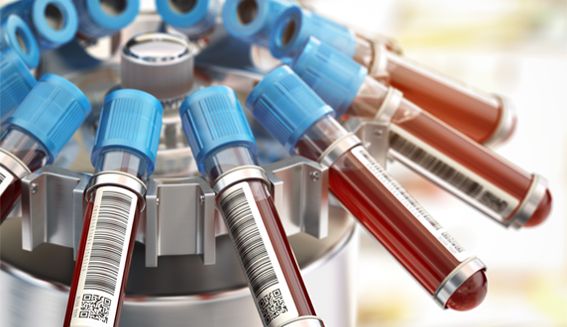 image of blood in a laboratory