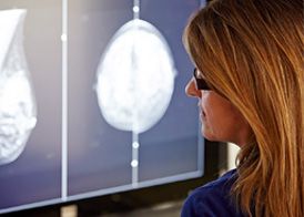 Photo of woman looking at breast imaging
