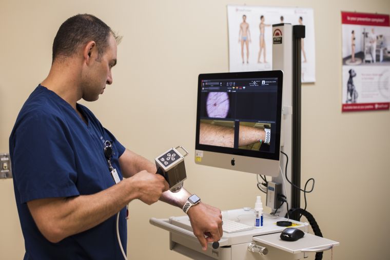 Man scans mole with scanner for AI analysis