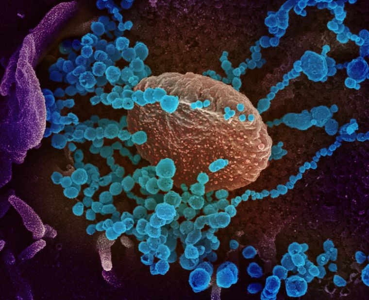 This scanning electron microscope image shows SARS-CoV-2 (round blue objects) emerging from the surface of cells cultured in the lab. SARS-CoV-2, also known as 2019-nCoV, is the virus that causes COVID-19.