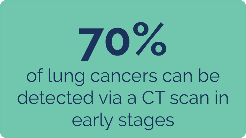 70% of lung cancers can be detected via a CT scan in early stages