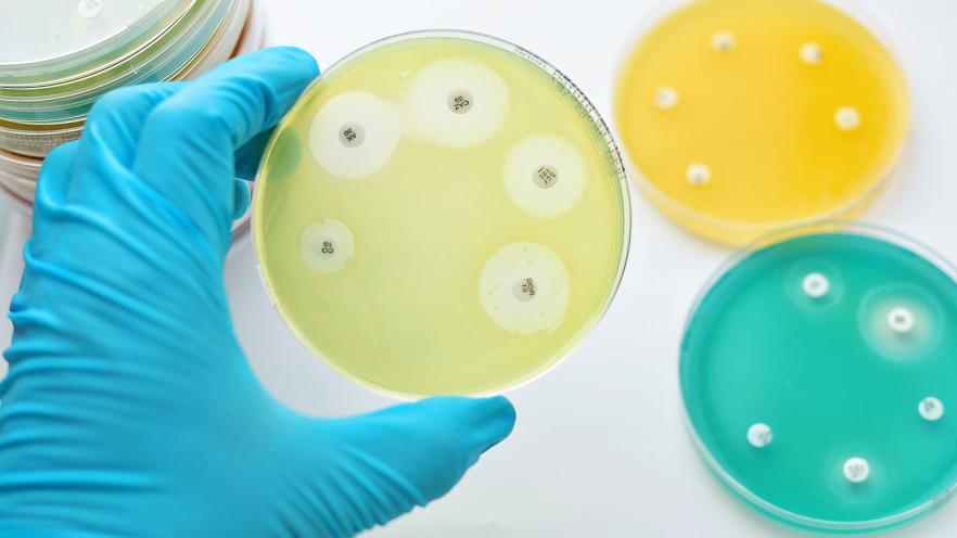 Petri dishes in a laboratory
