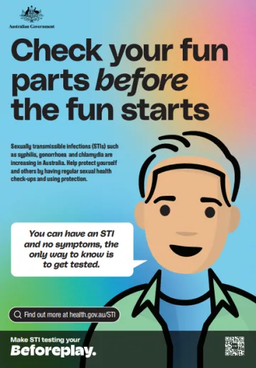 Check you fun parts before the fun starts