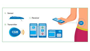 Continuous glucose monitoring product review