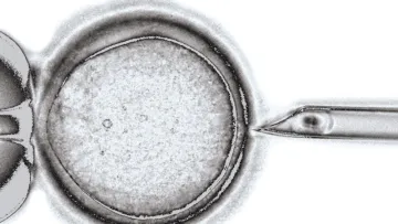 Share your views on making mitochondrial donation available in Australia