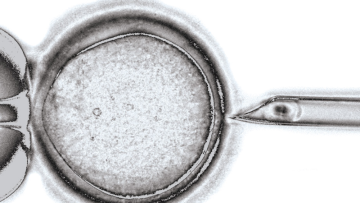 Share your views on making mitochondrial donation available in Australia