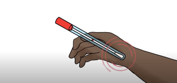 National Cervical Screening Program – How to take your own Cervical Screening Test sample