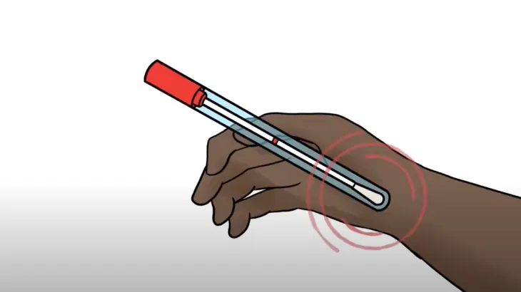 National Cervical Screening Program – How to take your own Cervical Screening Test sample